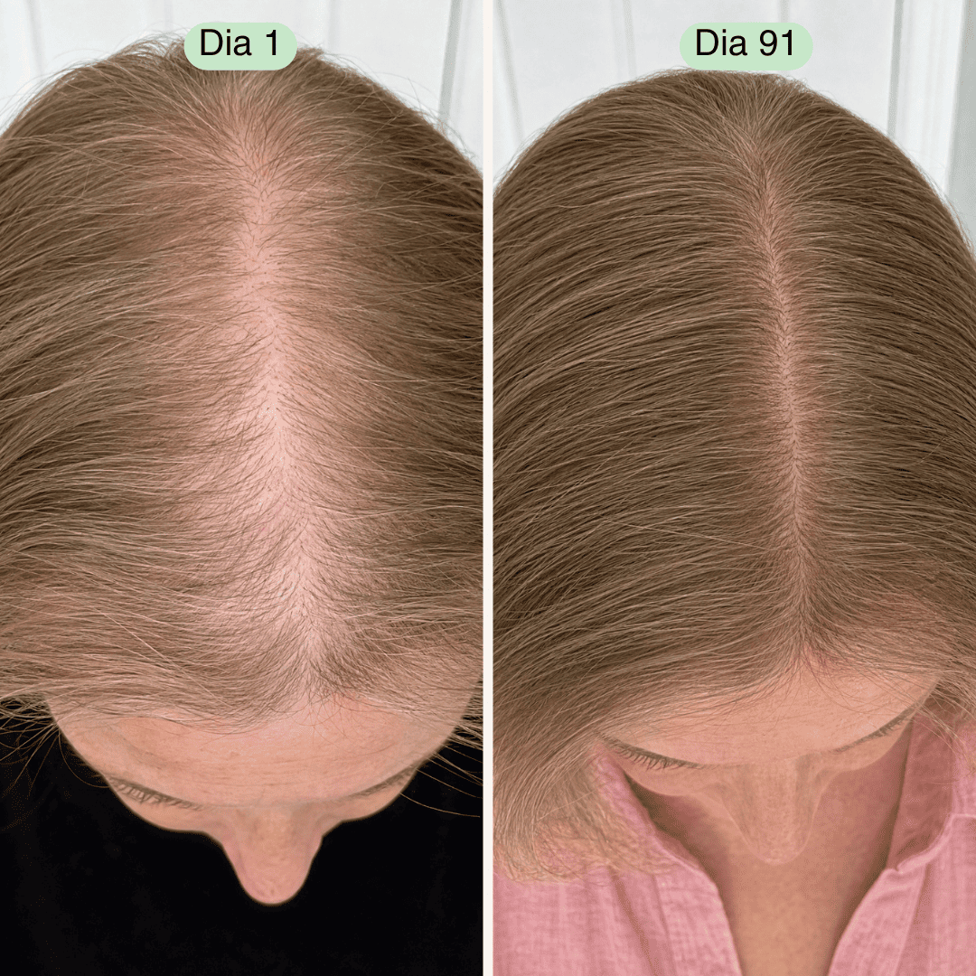 Protocolo Capilar para Mulheres 40+