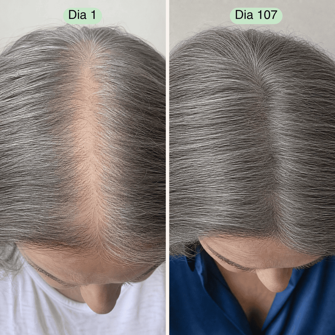 Protocolo Capilar para Mulheres 40+